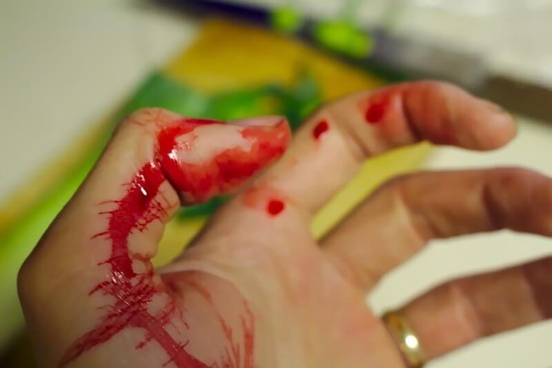 How to Control Bleeding - Wikinut
